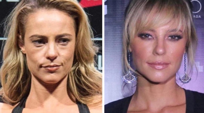 Preenchimento de Malar