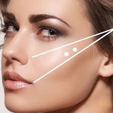 Preenchimento de Malar